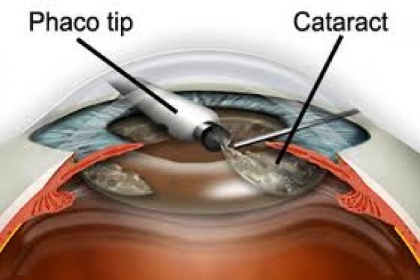 Jai Drishti Eye Hospital - Ophthalmology Images